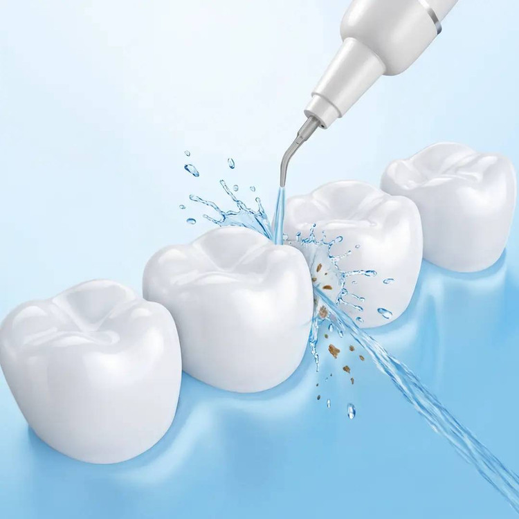 جرمگیر دندان گرین لاین مدلUltraSonic